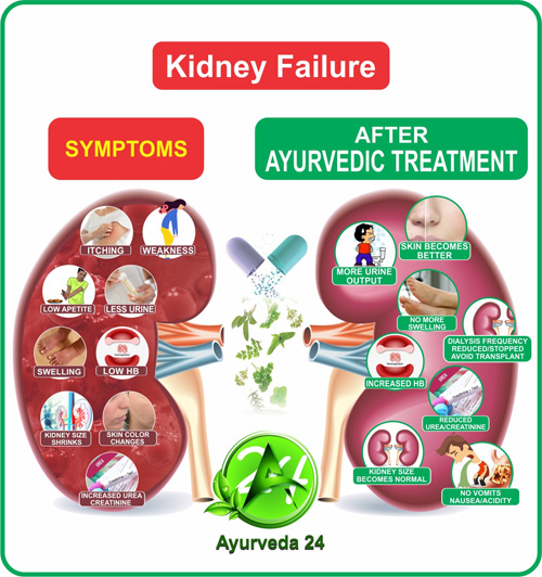 Ayurvedic-Treatment-for-kidney-failure